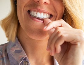 Woman putting in Invisalign